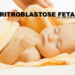 Eritroblastose Fetal