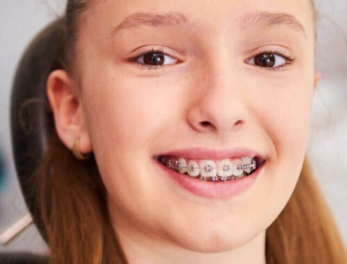 cropped-Retrato-de-crianca-sorridente-com-aparelho-no-consultorio-do-dentista.jpg